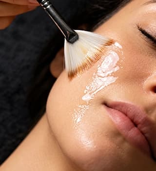 Chemical Peel