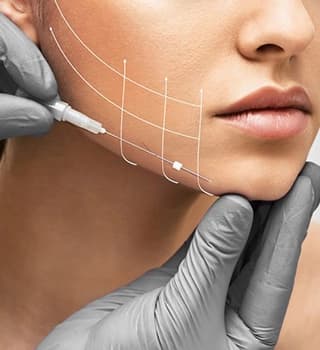 Thread Lift
